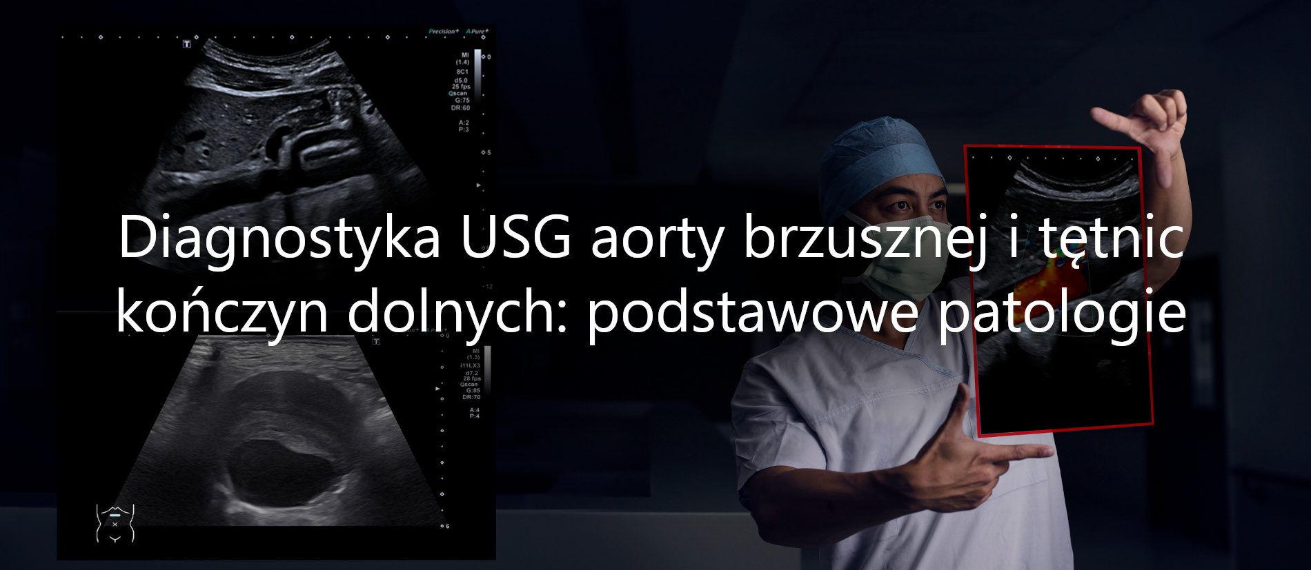 Kurs USG aorta brzuszna i tętnice kończyn dolnych