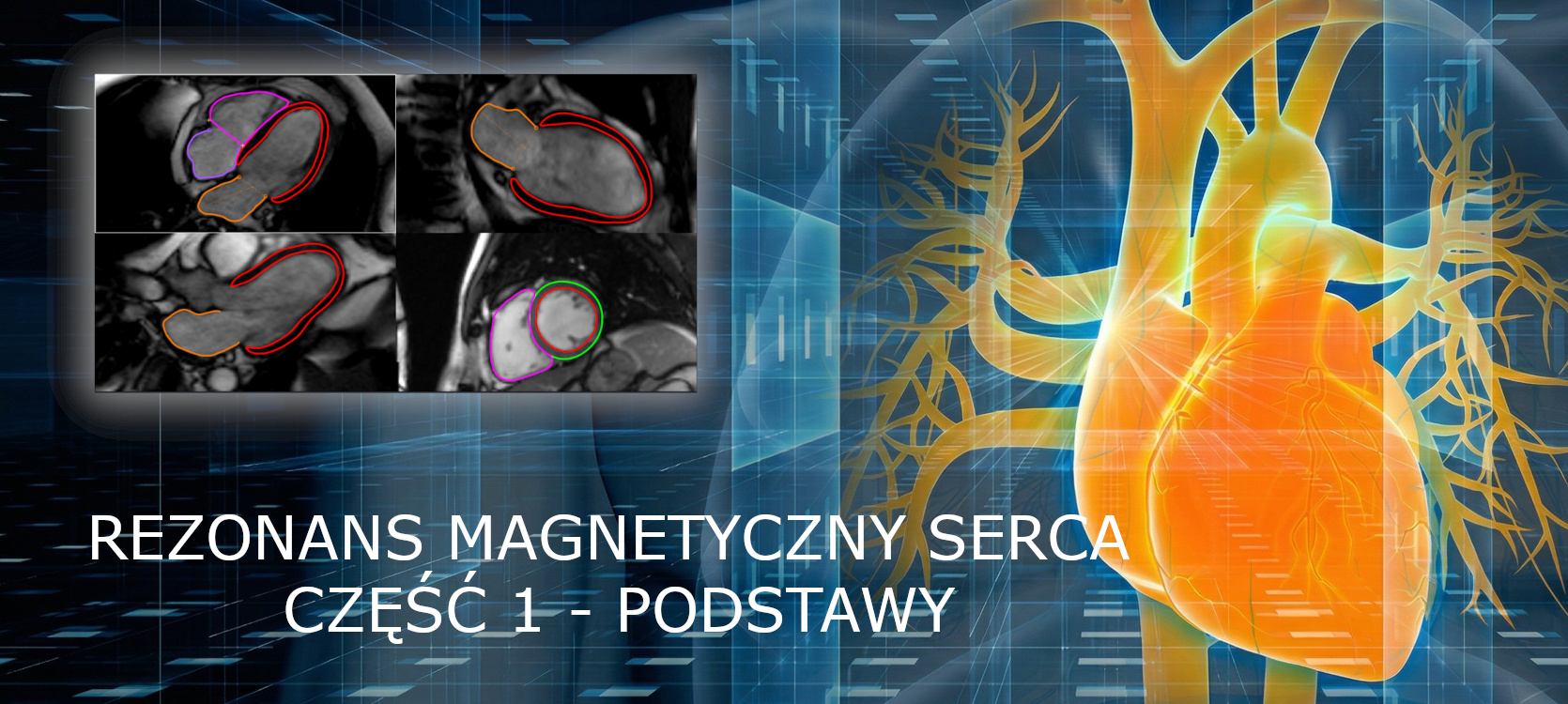 Kurs MRI serca (CMR)