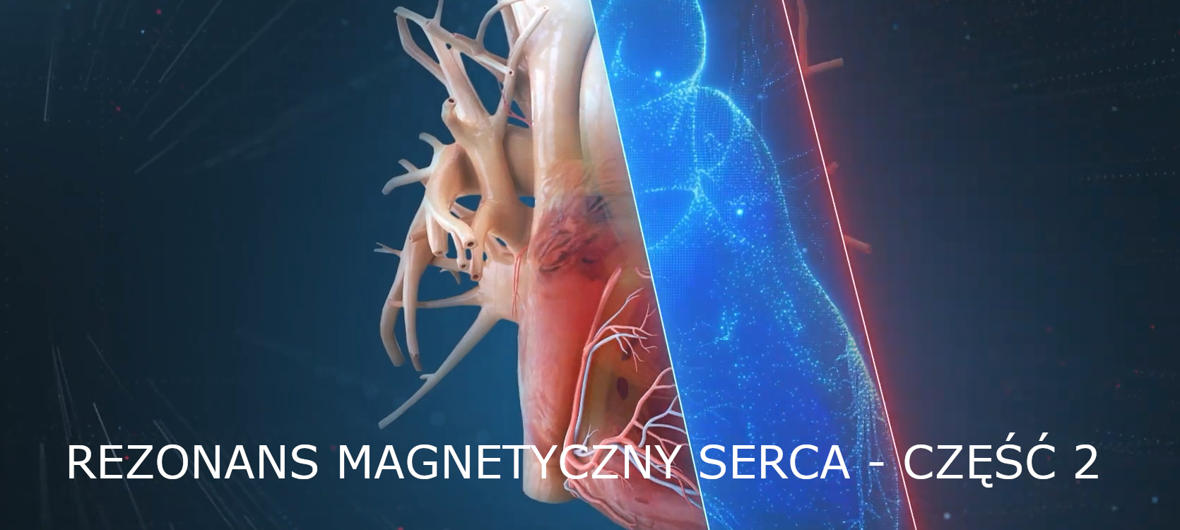 Kurs MRI serca (CMR)